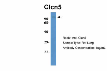Clcn5 Rabbit Polyclonal Antibody