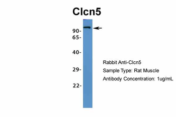 Clcn5 Rabbit Polyclonal Antibody