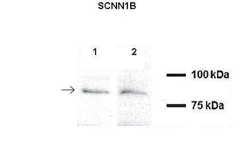 SCNN1B Rabbit Polyclonal Antibody