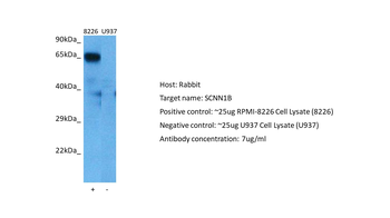 SCNN1B Rabbit Polyclonal Antibody