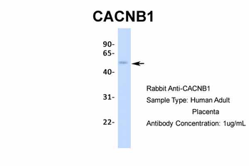 CACNB1 Rabbit Polyclonal Antibody