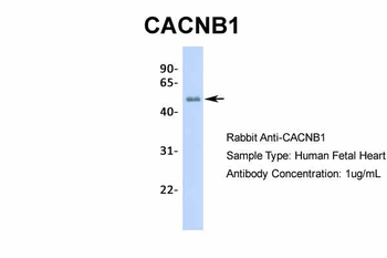 CACNB1 Rabbit Polyclonal Antibody