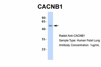 CACNB1 Rabbit Polyclonal Antibody