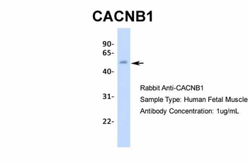 CACNB1 Rabbit Polyclonal Antibody