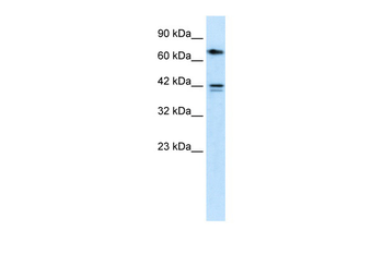 CACNB1 Rabbit Polyclonal Antibody