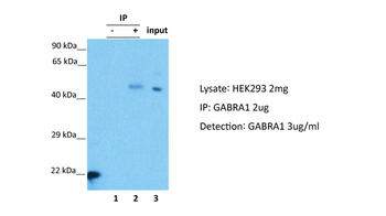 GABRA1 Rabbit Polyclonal Antibody