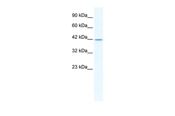 GABRA3 Rabbit Polyclonal Antibody