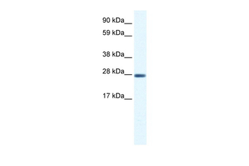 CLIC1 Rabbit Polyclonal Antibody