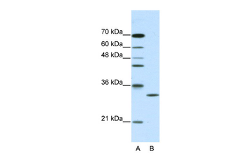 CLIC1 Rabbit Polyclonal Antibody