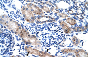 CLIC1 Rabbit Polyclonal Antibody