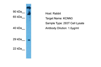 KCNN3 Rabbit Polyclonal Antibody