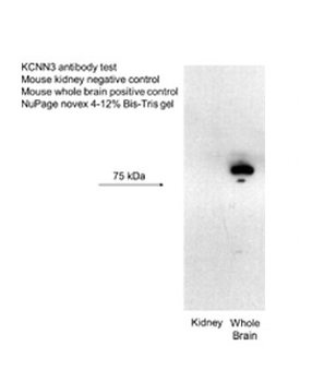 KCNN3 Rabbit Polyclonal Antibody