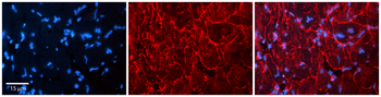 KCNN3 Rabbit Polyclonal Antibody