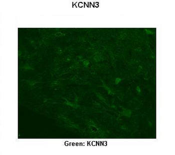 KCNN3 Rabbit Polyclonal Antibody