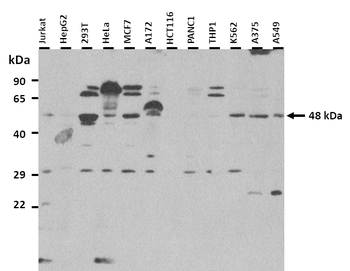 KCNN4 Rabbit Polyclonal Antibody