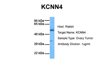 KCNN4 Rabbit Polyclonal Antibody