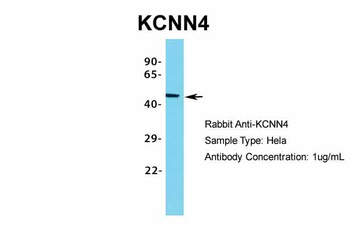 KCNN4 Rabbit Polyclonal Antibody