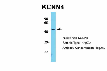 KCNN4 Rabbit Polyclonal Antibody