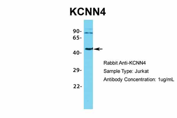KCNN4 Rabbit Polyclonal Antibody