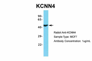 KCNN4 Rabbit Polyclonal Antibody