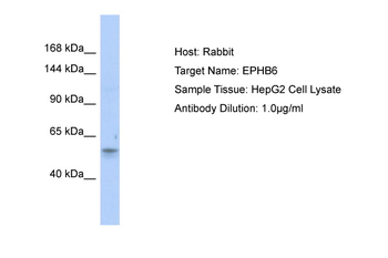 EPHB6 Rabbit Polyclonal Antibody