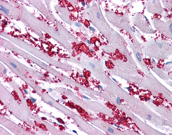 KCNA10 Rabbit Polyclonal Antibody