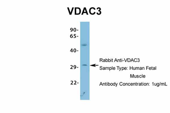 VDAC3 Rabbit Polyclonal Antibody
