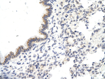 VDAC3 Rabbit Polyclonal Antibody