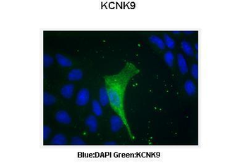 KCNK9 Rabbit Polyclonal Antibody