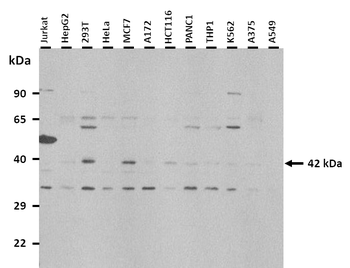 KCNK9 Rabbit Polyclonal Antibody