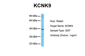 KCNK9 Rabbit Polyclonal Antibody