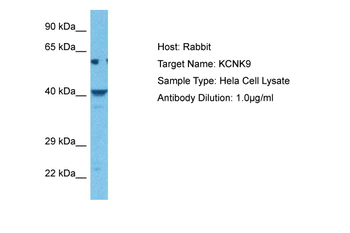 KCNK9 Rabbit Polyclonal Antibody