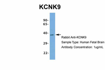 KCNK9 Rabbit Polyclonal Antibody