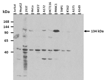TRPM4 Rabbit Polyclonal Antibody