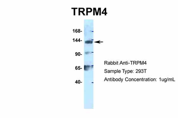 TRPM4 Rabbit Polyclonal Antibody