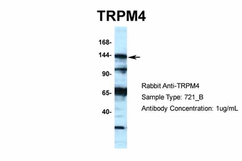 TRPM4 Rabbit Polyclonal Antibody