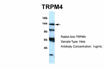 TRPM4 Rabbit Polyclonal Antibody