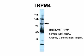 TRPM4 Rabbit Polyclonal Antibody