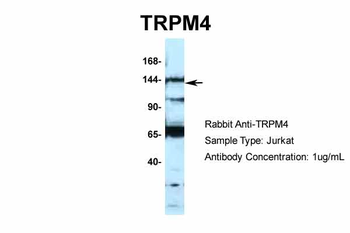TRPM4 Rabbit Polyclonal Antibody