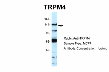 TRPM4 Rabbit Polyclonal Antibody