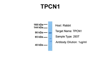 TPCN1 Rabbit Polyclonal Antibody