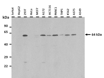 MCOLN3 Rabbit Polyclonal Antibody