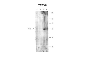 Trpv6 Rabbit Polyclonal Antibody
