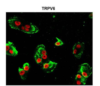 Trpv6 Rabbit Polyclonal Antibody