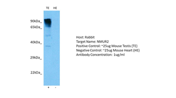 NMUR2 Rabbit Polyclonal Antibody