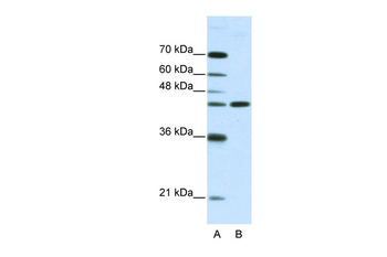 NMUR2 Rabbit Polyclonal Antibody