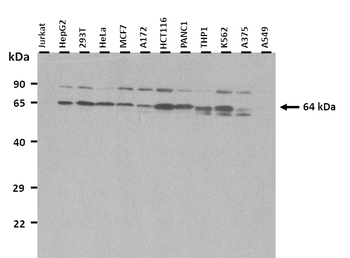 MCOLN1 Rabbit Polyclonal Antibody