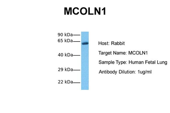 MCOLN1 Rabbit Polyclonal Antibody
