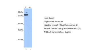 MCOLN1 Rabbit Polyclonal Antibody