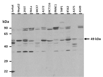 KCNJ12 Rabbit Polyclonal Antibody
